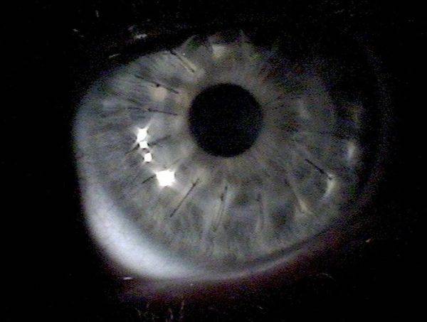 Тюнинг глаз (10 фото)