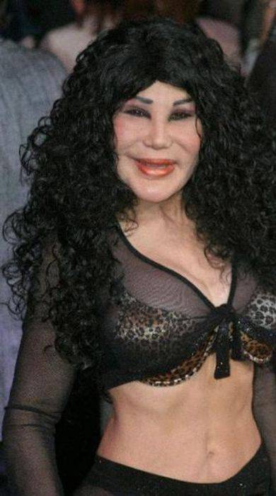    (63 )