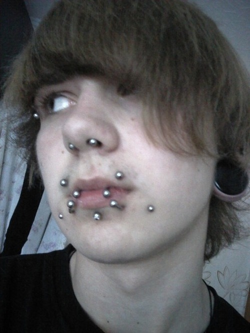        (17 )