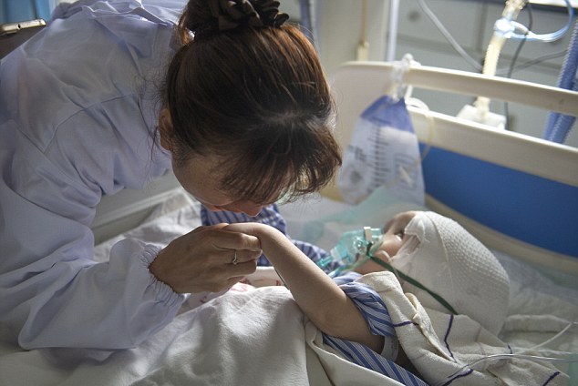 3-летней девочке в Китае пересадили череп (8 фото)