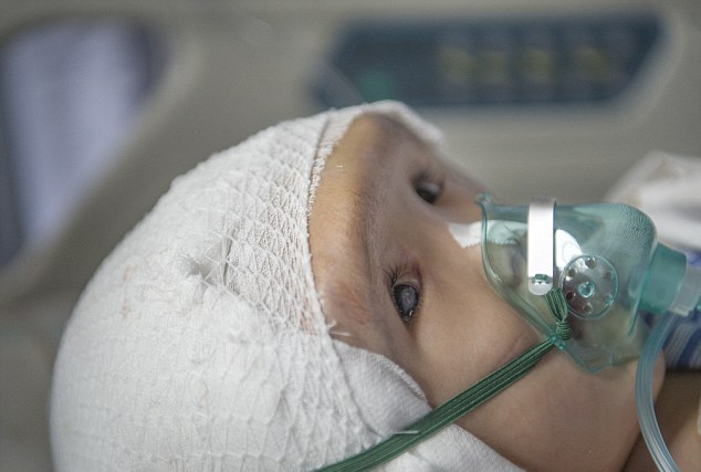 3-летней девочке в Китае пересадили череп (8 фото)