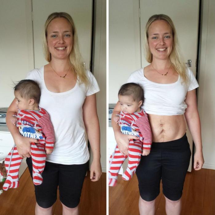 Мама показала как менялось её тело в течение 14 дней после родов (7 фото)