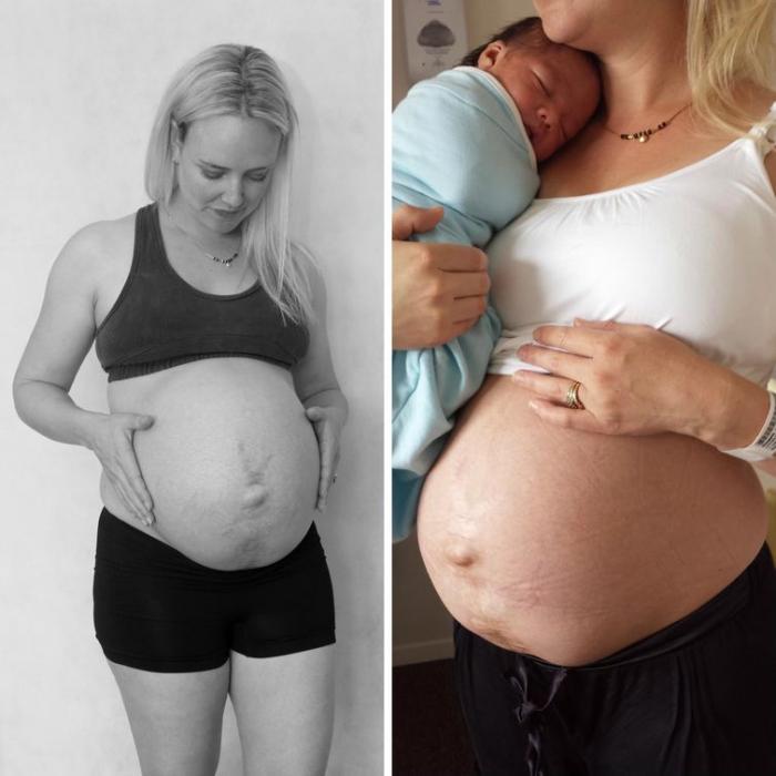 Мама показала как менялось её тело в течение 14 дней после родов (7 фото)