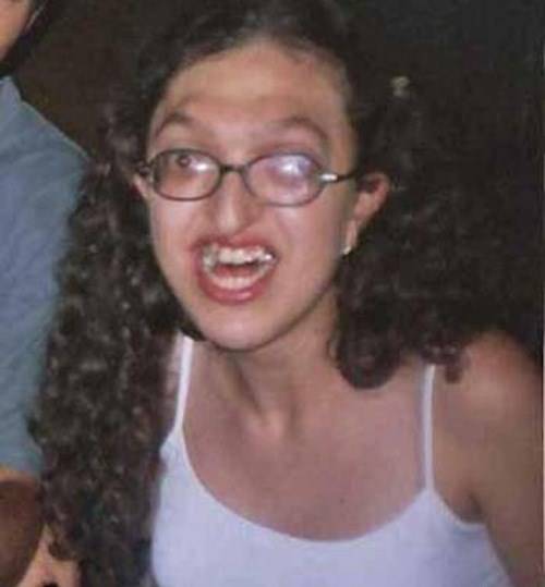   (45 )
