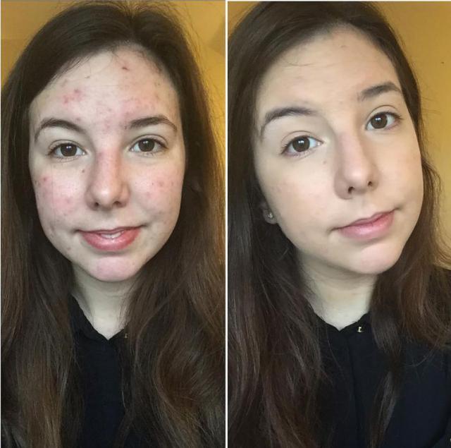           (23 )