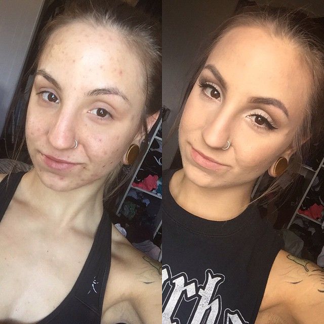           (23 )