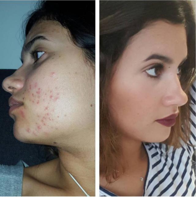           (23 )