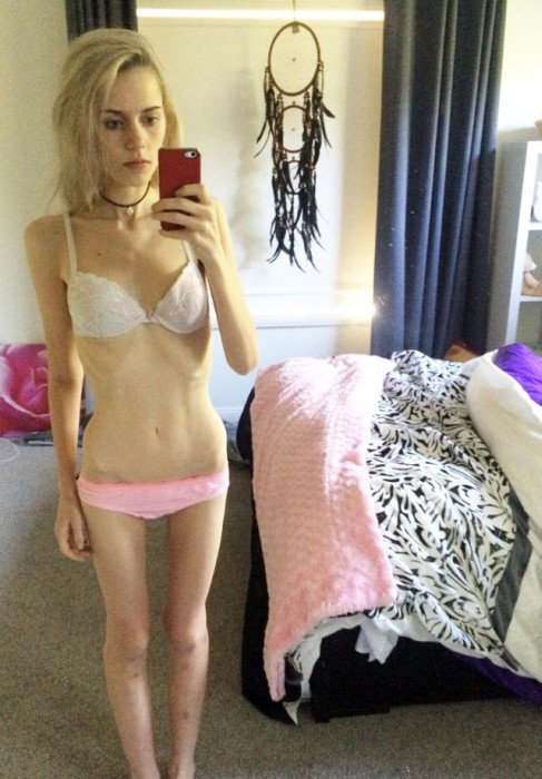     (11 )