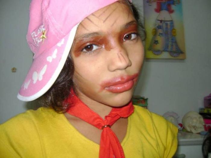   (44 )