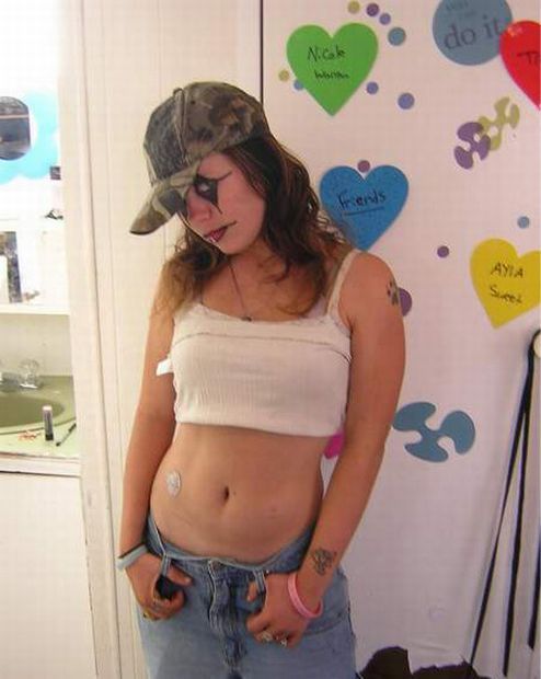   (44 )