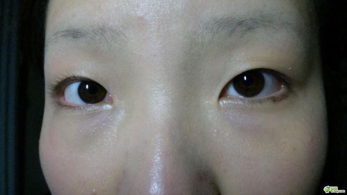    (30 )