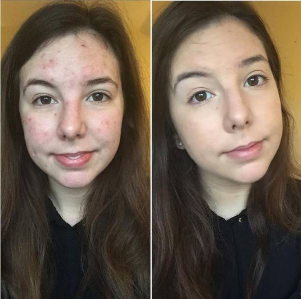      (22 )