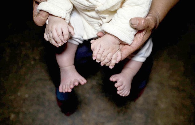 В Китае родился мальчик у которого 31 палец (5 фото) В Китае родился мальчик у которого 31 палец (5 фото)