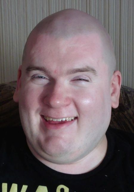      35    (10 )
