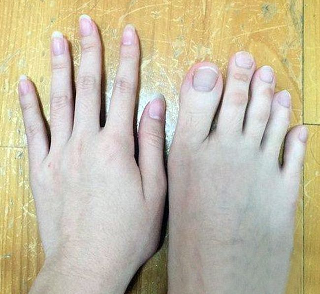        (5 )