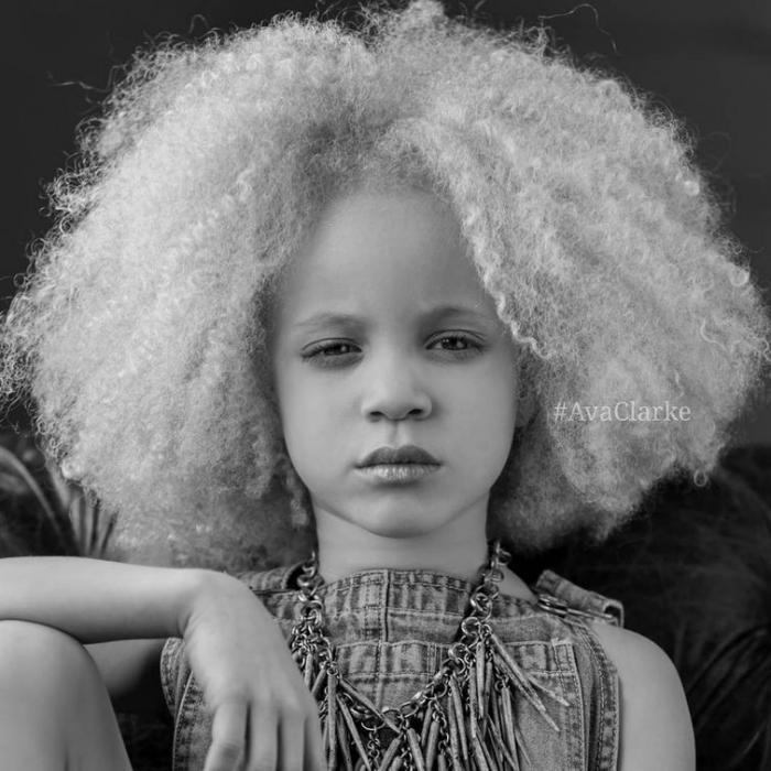 Ава Кларк – 8-летняя девочка-альбинос, ставшая моделью (13 фото) Ава Кларк – 8-летняя девочка-альбинос, ставшая моделью (13 фото)