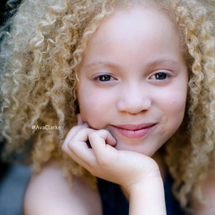Ава Кларк – 8-летняя девочка-альбинос, ставшая моделью (13 фото) Ава Кларк – 8-летняя девочка-альбинос, ставшая моделью (13 фото)