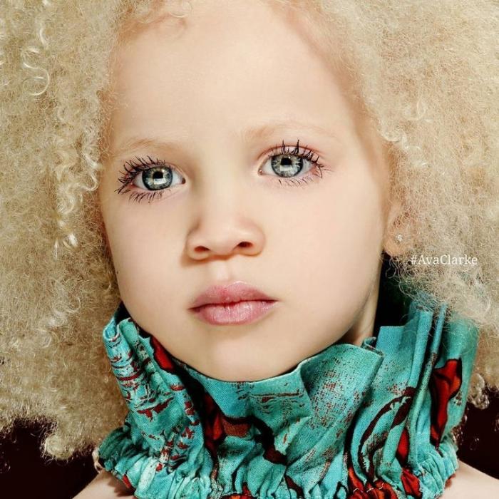 Ава Кларк – 8-летняя девочка-альбинос, ставшая моделью (13 фото) Ава Кларк – 8-летняя девочка-альбинос, ставшая моделью (13 фото)