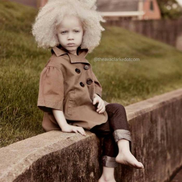 Ава Кларк – 8-летняя девочка-альбинос, ставшая моделью (13 фото) Ава Кларк – 8-летняя девочка-альбинос, ставшая моделью (13 фото)