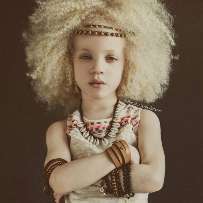 Ава Кларк – 8-летняя девочка-альбинос, ставшая моделью (13 фото) Ава Кларк – 8-летняя девочка-альбинос, ставшая моделью (13 фото)