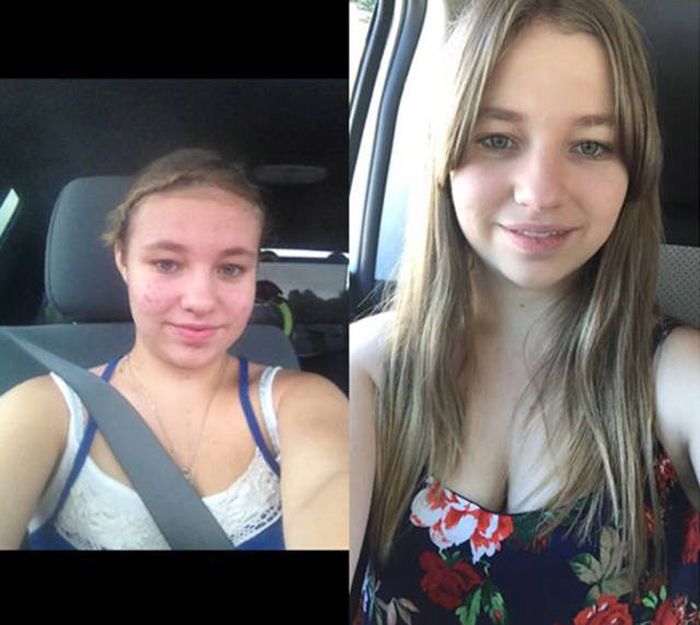       (18 )