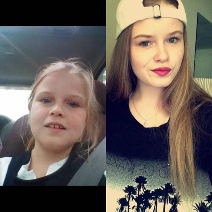      (18 )