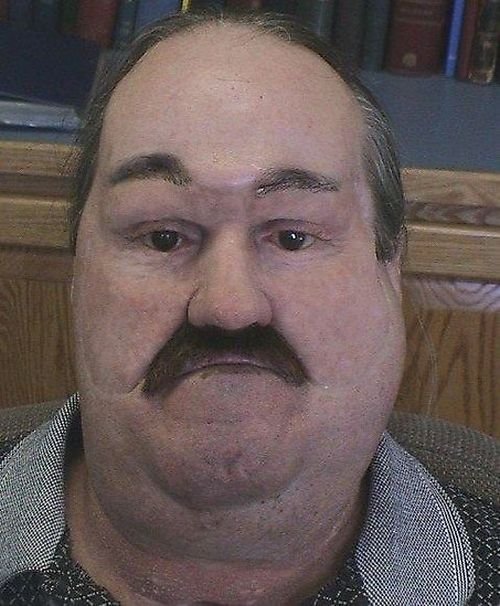  (16 )