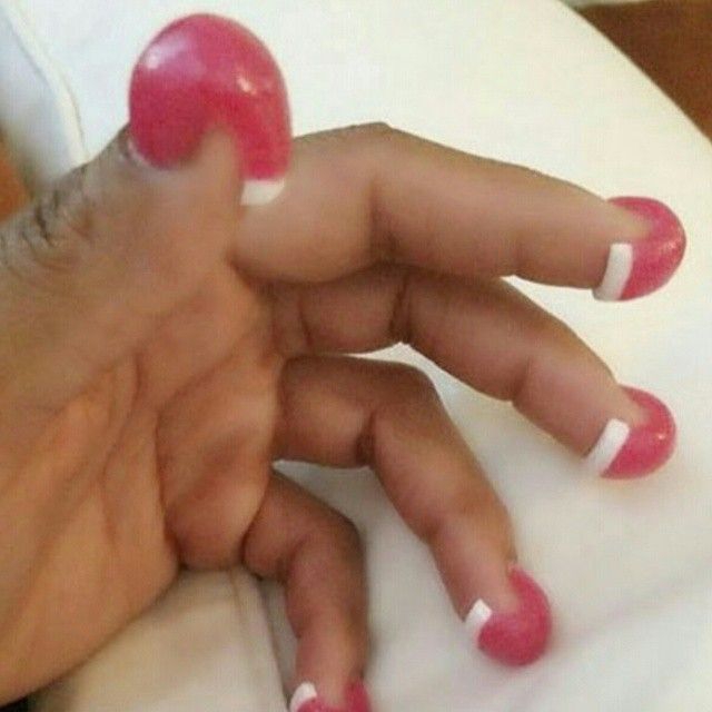     -   (7 )