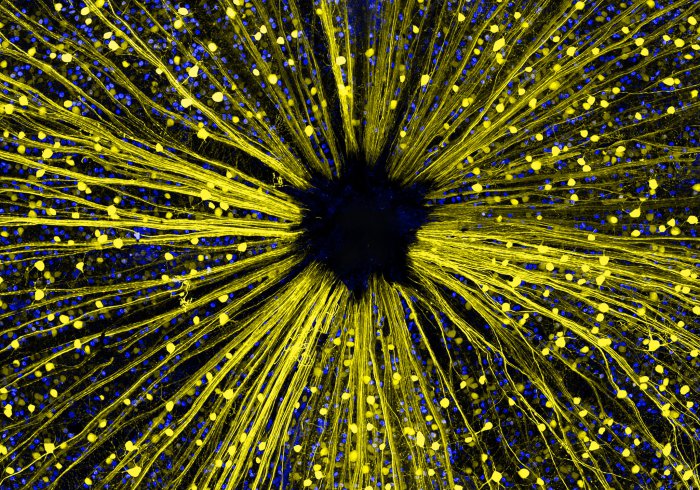 Снимки фотоконкурса «Nikon Small World 2016» (18 фото) Снимки фотоконкурса «Nikon Small World 2016» (18 фото)