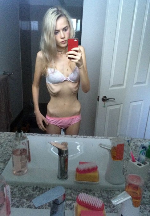      (11 )