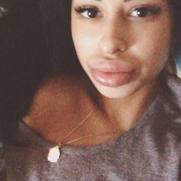     (21 )