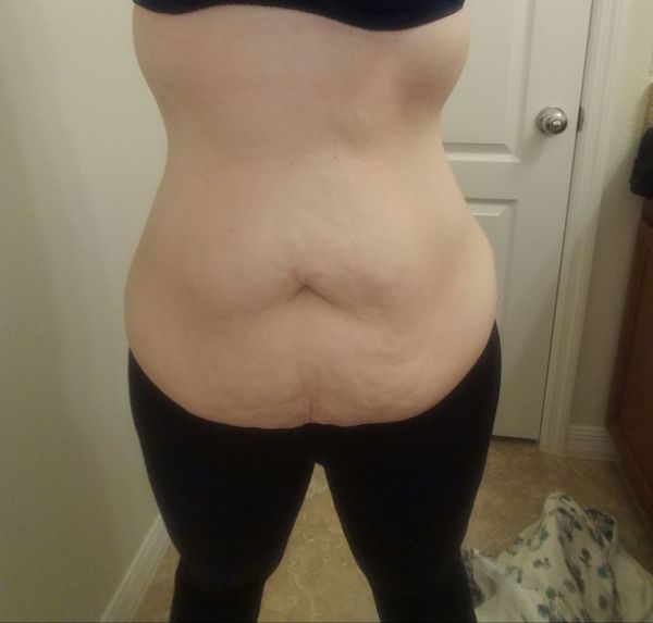      (5 )