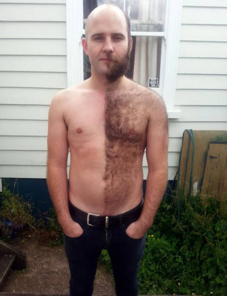   (40 )