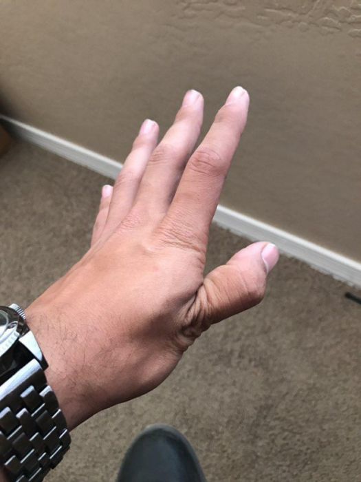        (14 )