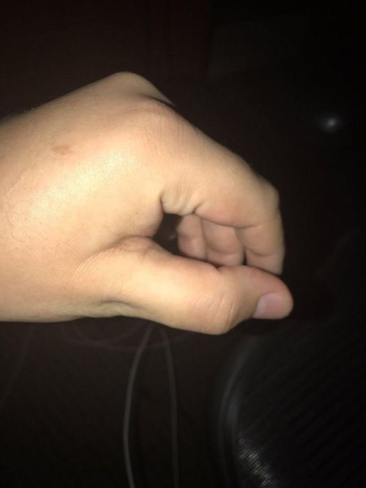        (14 )