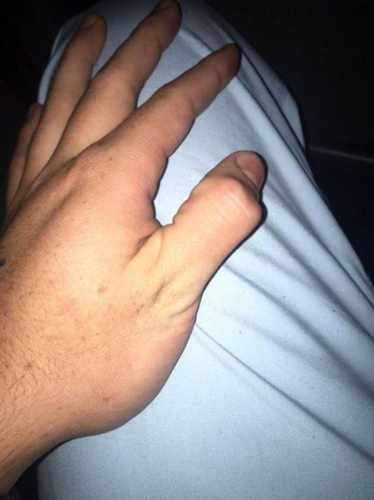        (14 )
