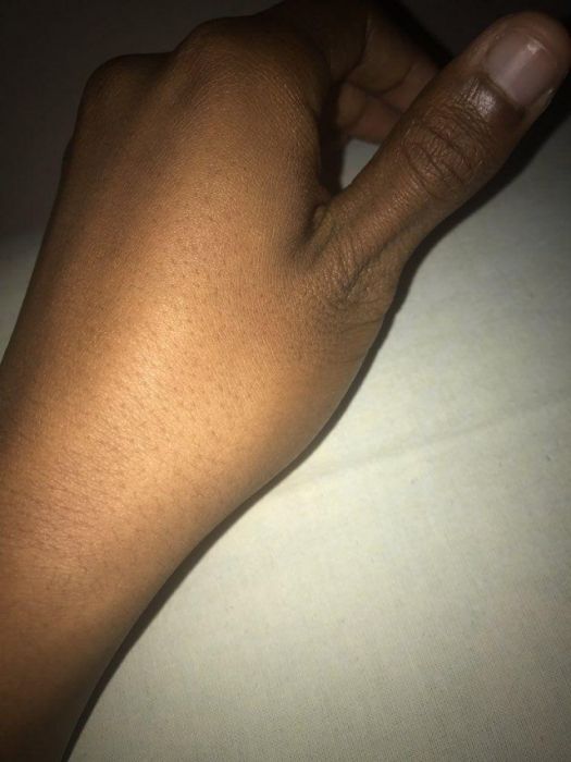        (14 )