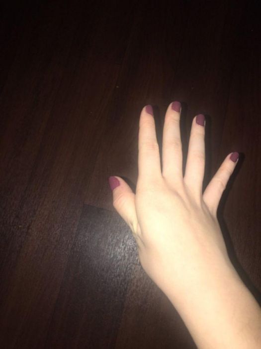        (14 )