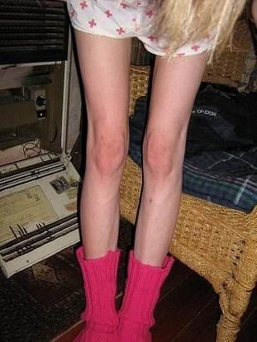  (19 )