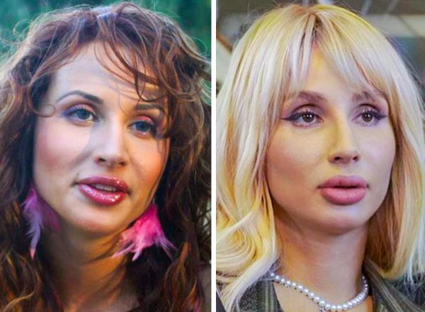 Российские знаменитости которые изменились до неузнаваемости (11 фото)