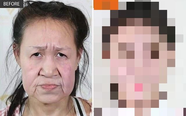 15-летнюю китаянку путали с бабушкой, но сделали операцию (8 фото)  