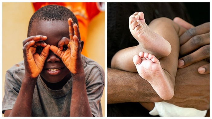 Почему у темнокожих людей светлые ступни и ладони (9 фото)